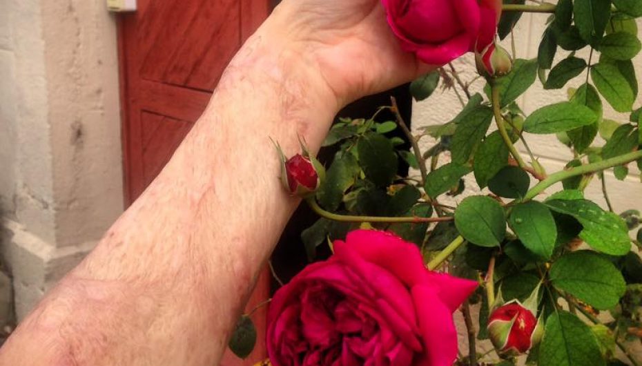 “Tregoi shenjat e tua si të ishin lule”