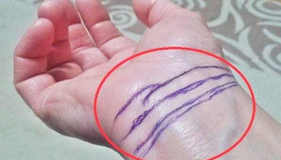 Numri i rrathëve në duar iu tregon për jetëgjatësinë, famën, pasurinë, shëndetin…