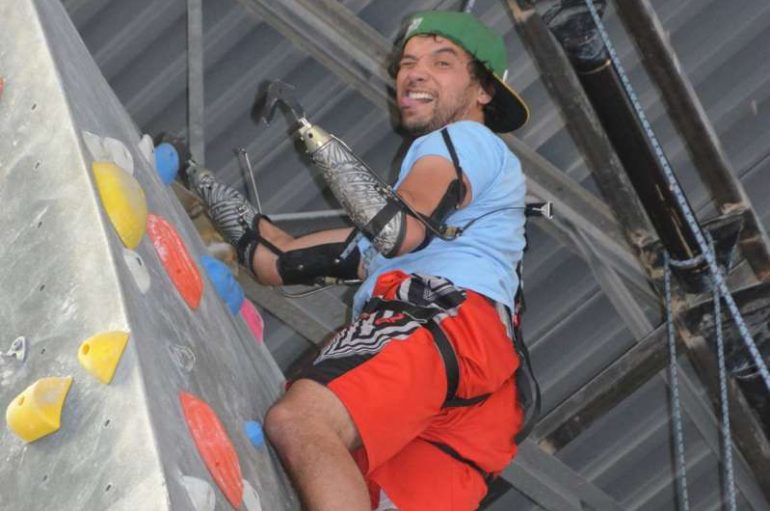 I prenë duart pas aksidentit, gangsteri pa gjymtyrë sot bën gjëra të jashtëzakonshme