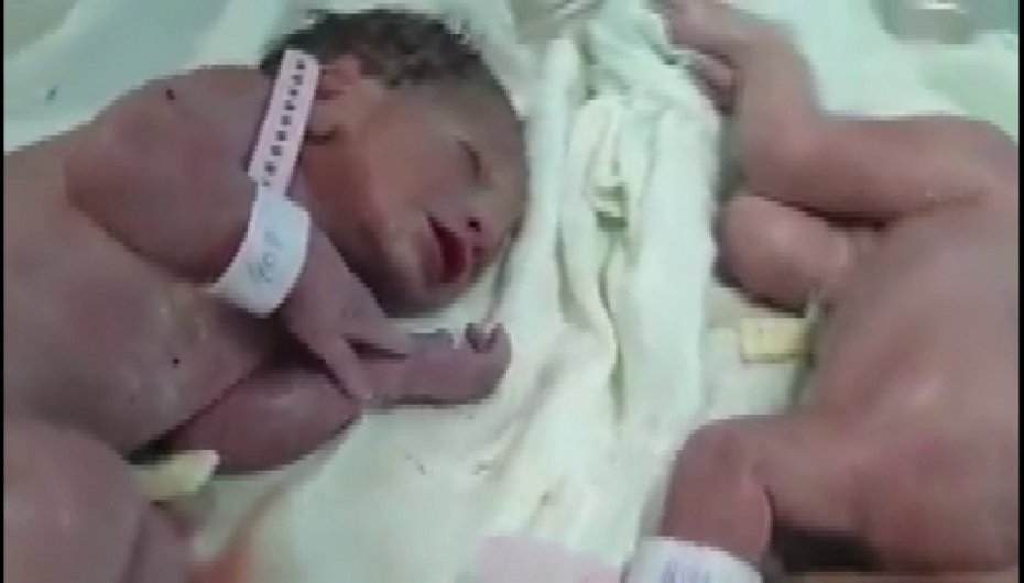 Binakët vijnë në jetë 20 minuta pas tërmetit